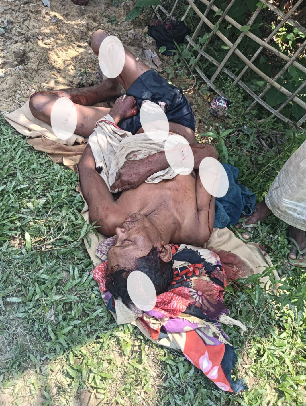 डिगबोई में सनसनीखेज हत्याकांड: घरेलू विवाद में छोटे भाई ने बड़े भाई को उतारा मौत के घाट